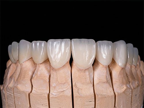 Cosmetic Dentistry